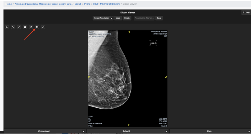 DICOM image