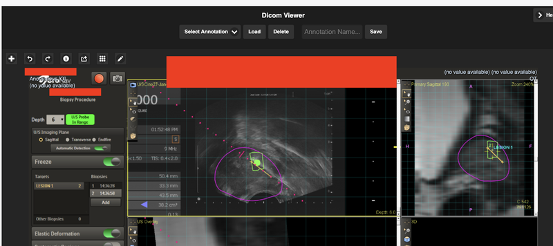 Possible Burned-in PHI/PII (Pixels)