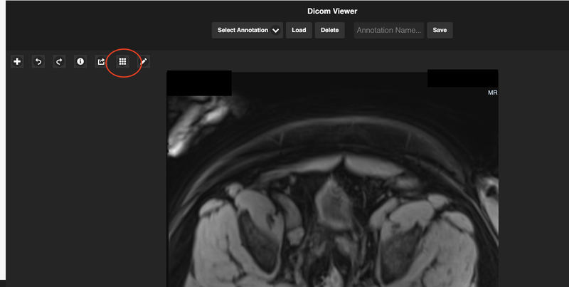Open DICOM Header Tags